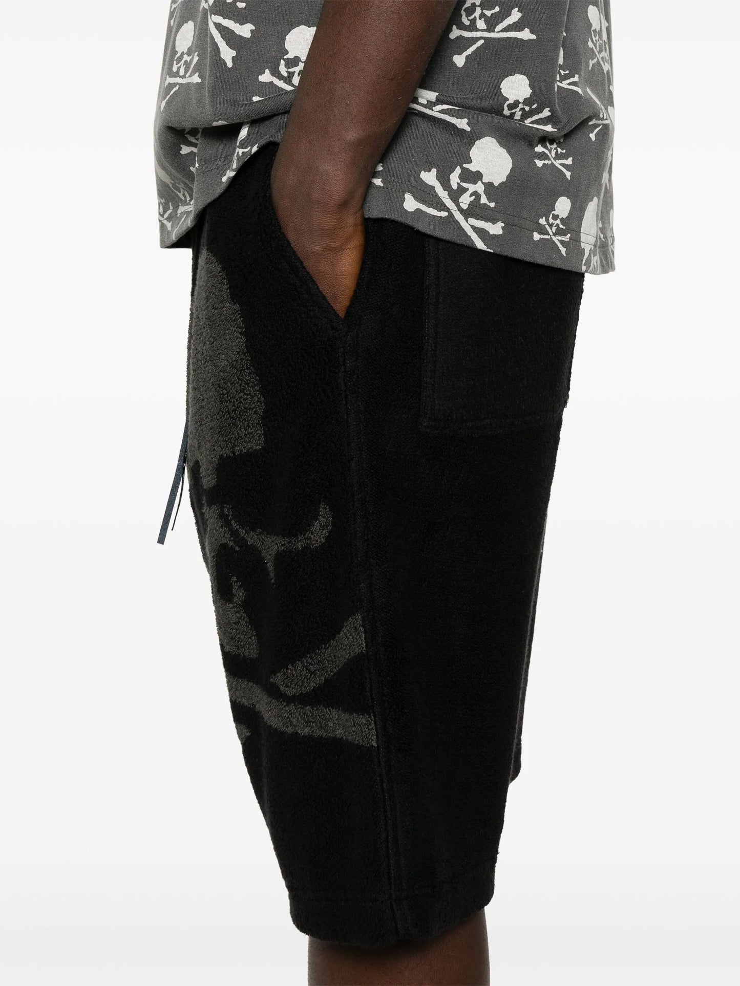 terry-cloth shorts