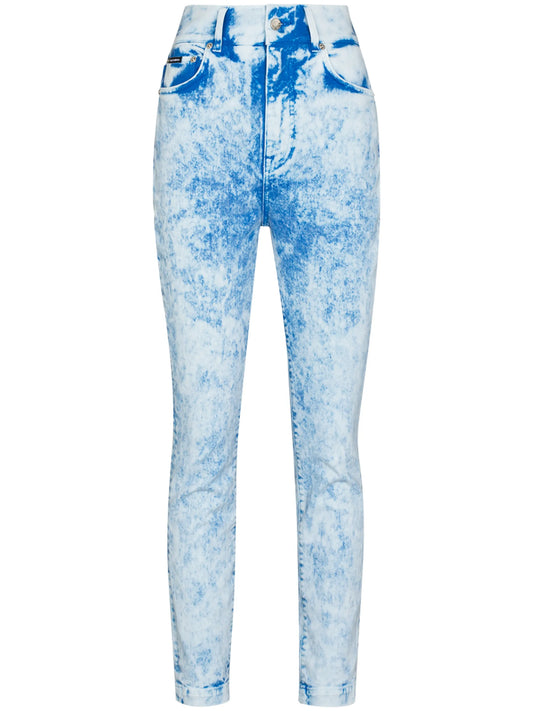 acid wash skinny jeans
