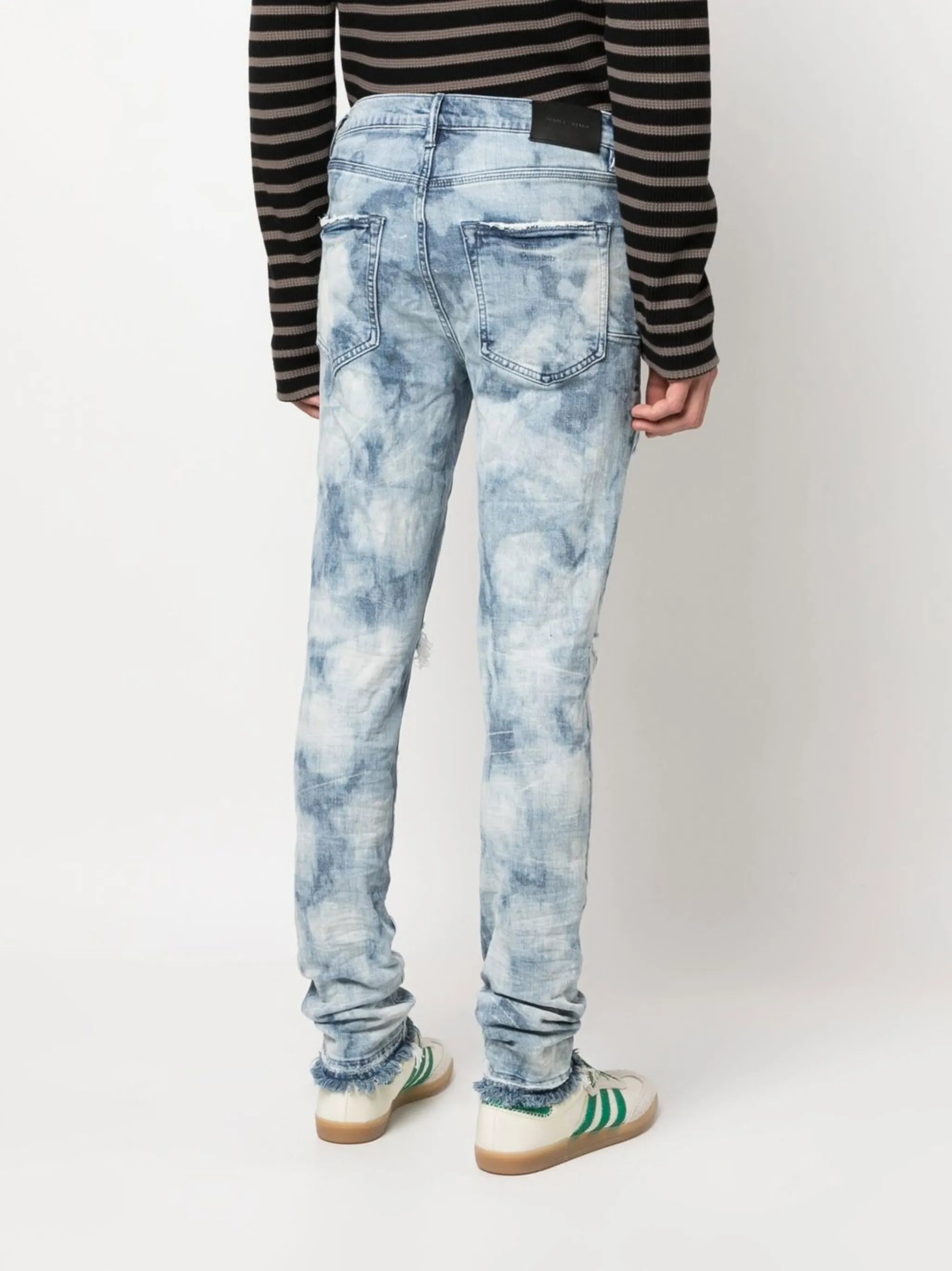 distressed skinny jeans