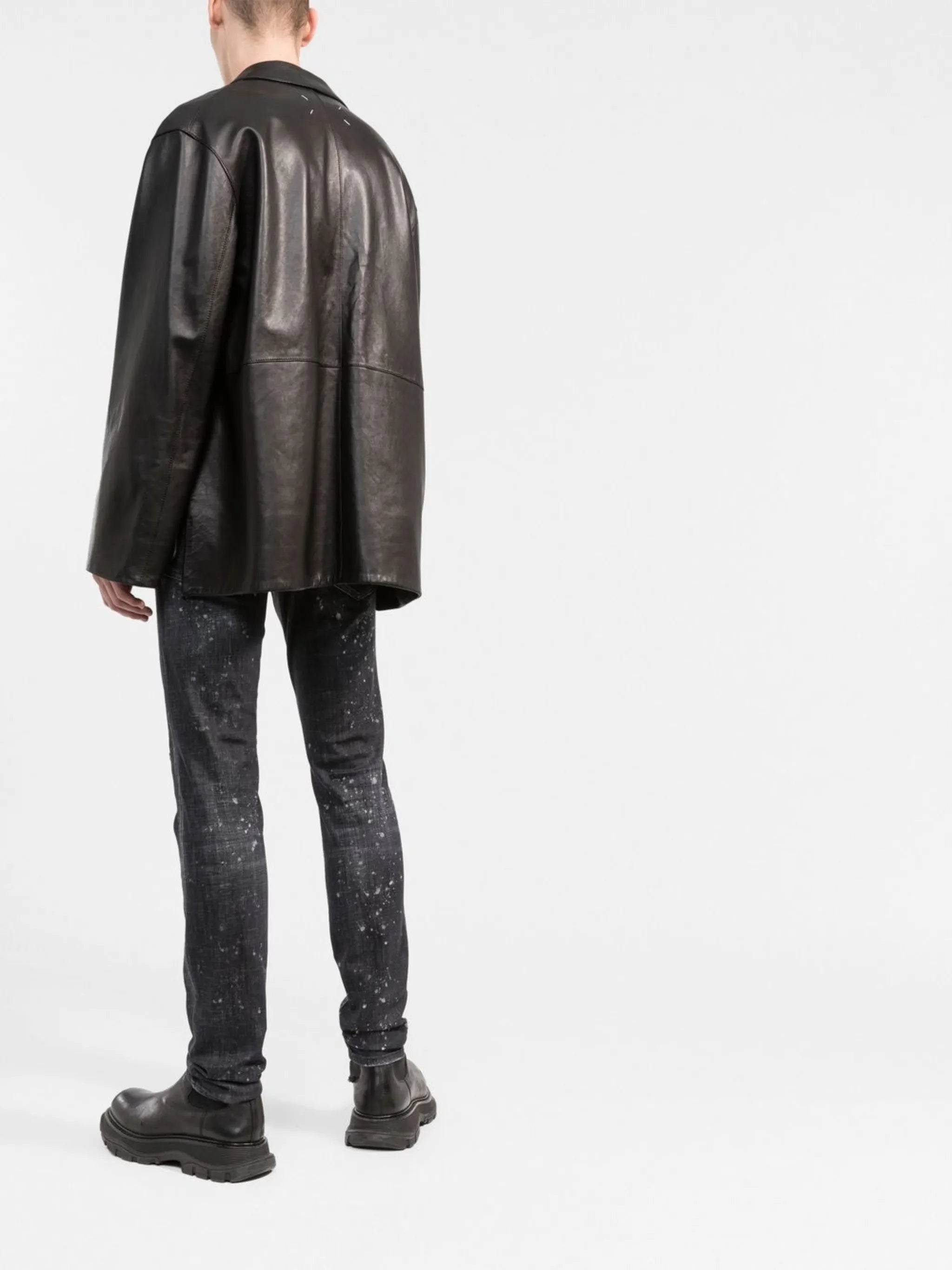 distressed skinny jeans