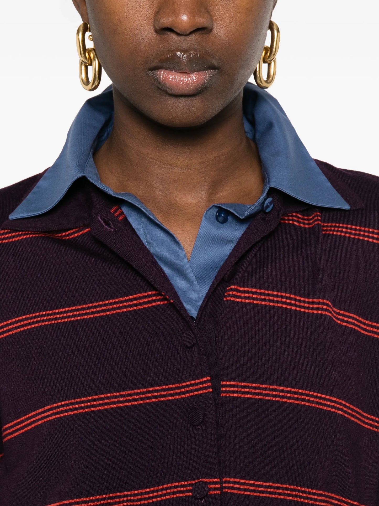 striped buttoned polo top